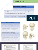 Clasificación de deformidades de la ATM