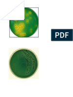 Bile salt string test identification of Vibrio cholerae