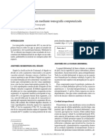 Anatomia de Abdomen X Tac