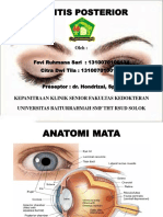 Uveitis