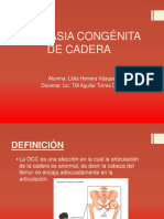 Displasia Congénita de Cadera