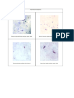 Plasmodium Falciparum