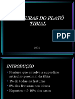 Fraturas Do Platô Tibial