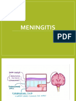 Meningitis