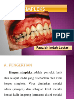 Cara Mencegah Penularan Herpes Simpleks