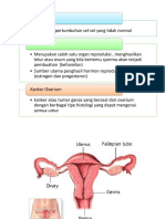 Kanker Ovarium