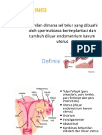 Kehamilan Ektopik Terganggu