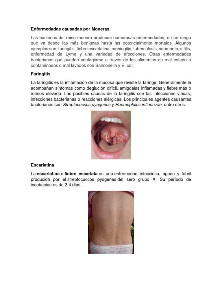 Enfermedades Causadas Por Moneras | PDF | Meningitis | Las bacterias