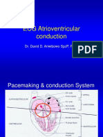 09 ECG Atrioventricular conduction.ppt