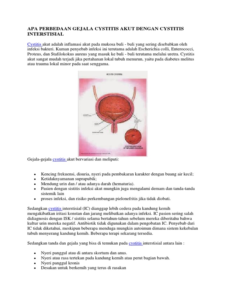 Perbedaan Gejala Cystitis Akut dan Interstisial | PDF