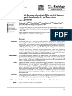 Magnetic Resonance Imaging in Differentatial Diagnosis of Pyogenic Spondylodiscitis and Tuberculous Spondylodiscitis