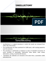 Tonsillectomy