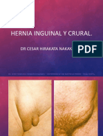 Hernias Inguinales 2017a