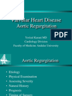 Valvular Heart Disease: Aortic Regurgitation