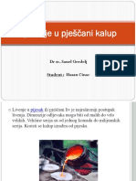 Lijevanje U Pješčani Kalup