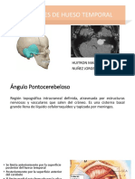 Schwannoma-Vestibular.pptx