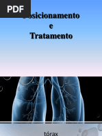 RADIOTERAPIA