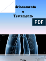 RADIOTERAPIA