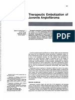 Therapeutic Embolization of Juvenile Angiofibroma: C. Price3 James M. Davis'