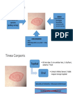 Tinea Corporis