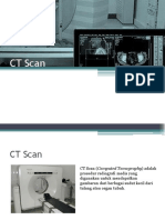 CT Scan 06032
