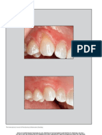 A Decision Tree For Soft Tissue Grafting