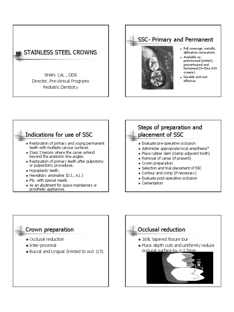 stainlesssteelcrowns.pdf Dentistry Mouth