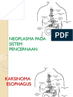 Neoplasma Pada Sistem Pencernaan Esophagus Dan Kolorektal