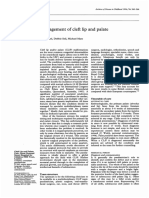 management cleft palate