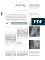 Conflito Femoro Acetabular