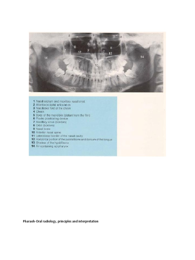 PharaohOral Radiology, Principles and Interpretation PDF