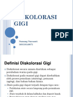 Diskolorasi Gigi