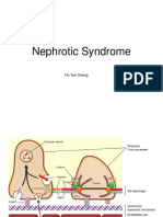 Nephrotic Syndrome Johnny