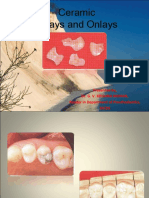 Ceramic Inlays and Onlays: Presented By, Dr. G. V. Krishna Mohan, Reader in Department of Prosthodontics, Sscds