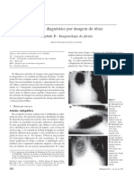 Pleurias em radiografia s.pdf