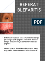 Referat Mata Blefaritis