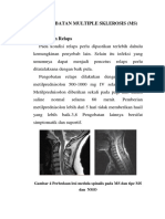 Pengobatan Multiple Sklerosis