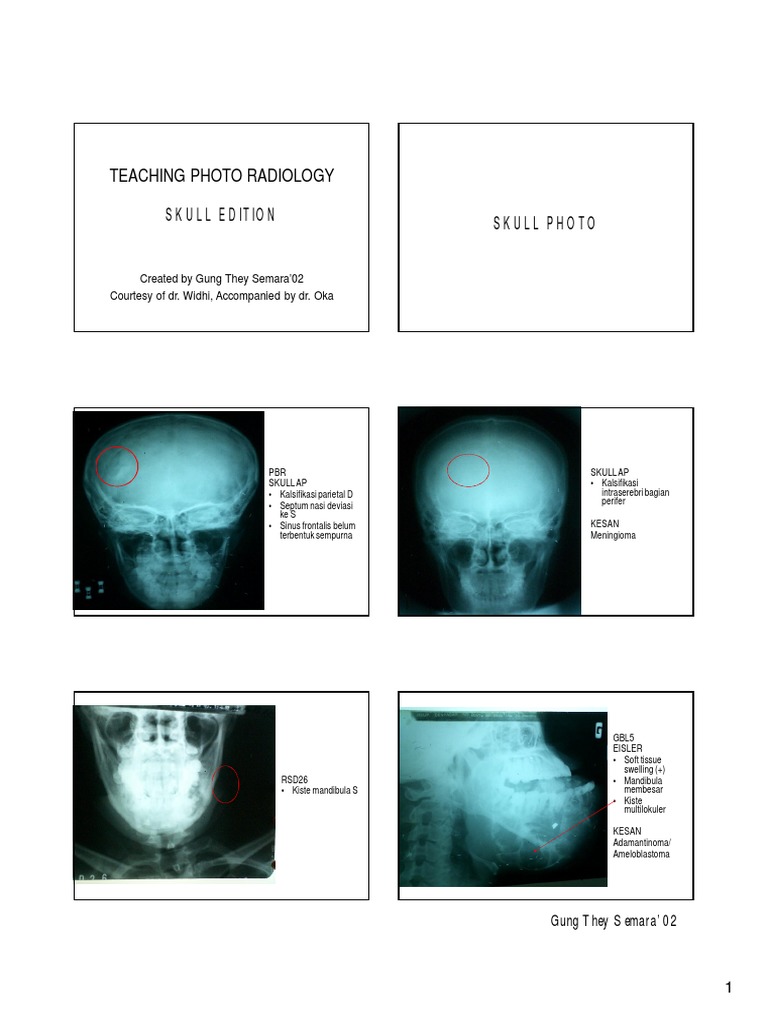 Teaching Photo Radiology: Skull Edition | PDF