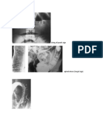 Gambaran Radiologi