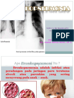 Bronkopneumoni RSPN