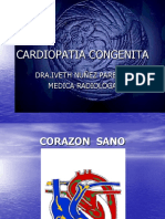 cardiopatia congenita rx.ppt