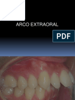 ARCO EXTRAORAL.ppt