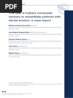 indirect veneer composite.pdf