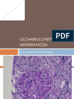 Glomerulonefritis Membranosa