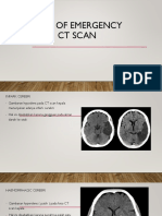 Case of Emergency CT Scan