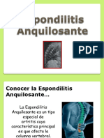 Espondilitis Anquilosantes