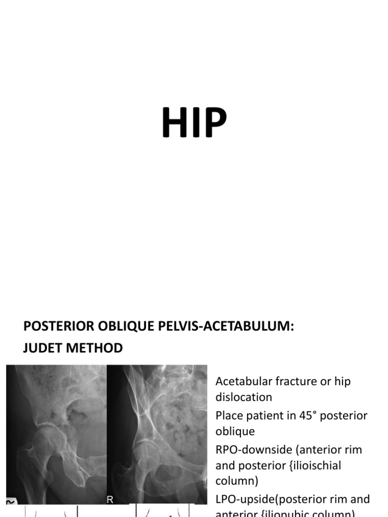 Supp Hip Only Hip Anatomical Terms Of Location Free 30day Trial