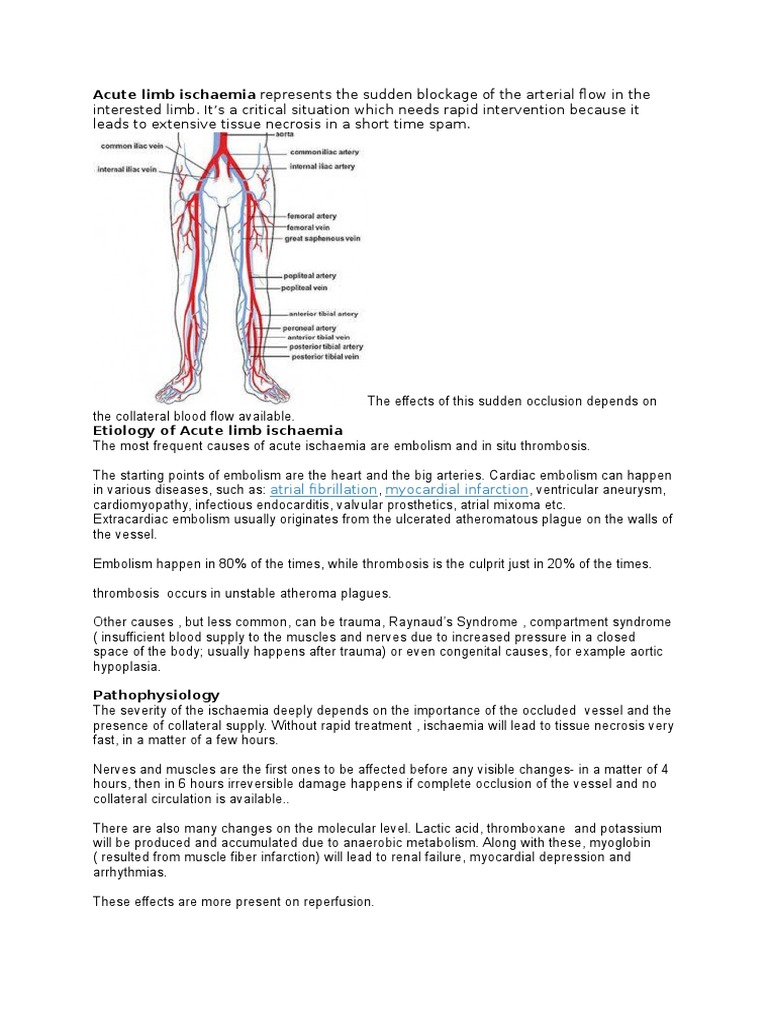 Acute Limb Ischaemia: Causes & Treatment | PDF | Ischemia | Thrombosis