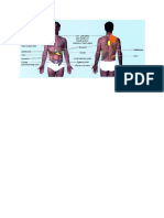 Referred Pain of The Trunk and Abdomen