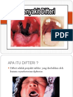 DIFTERI-PENYAKIT-INFEKSI-YANG-DISEBABKAN-OLEH-KUMAN-CORYNEBACTERIUM-DIPHTERIAE